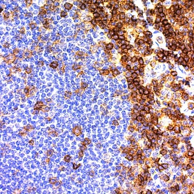 CD43 (T-Cell); Clone DF-T1 (Ready-To-Use)
